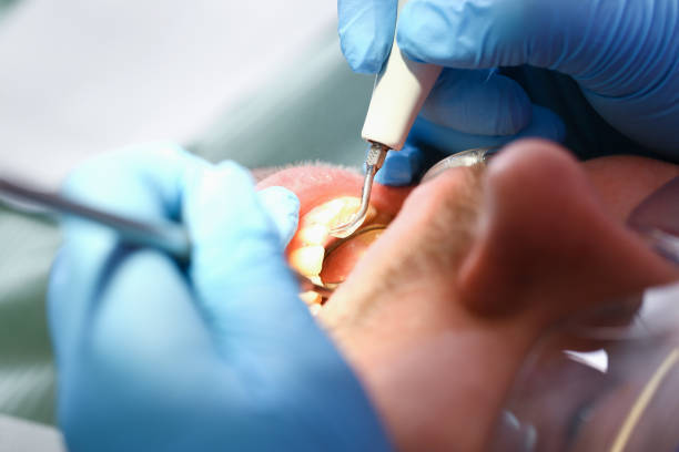 Best Dentist for Tooth Abscess  in Oxon Hill, MD