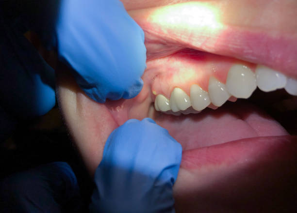 Best Urgent Tooth Repair  in Oxon Hill, MD